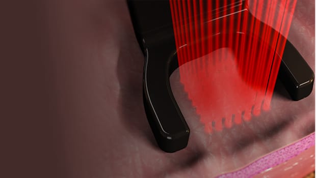 Bio-Stimulation & Laser: Die Wissenschaft hinter Harmony Bio-Boost